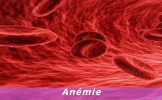 Anémie
