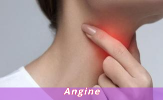 Angine
