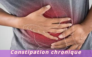 Constipation chronique