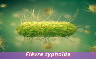 Fièvre typhoïde