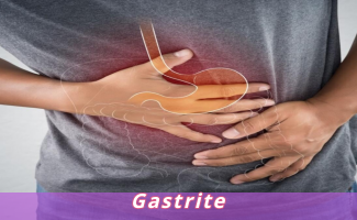 Gastrite