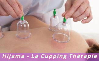Hijama - La Cupping Thérapie