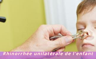 Rhinorrhée unilatérale de l'enfant