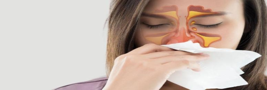 Sinusite :  symptômes, causes, traitement, prévention