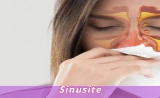 Sinusite