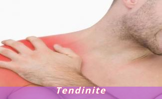 Tendinite
