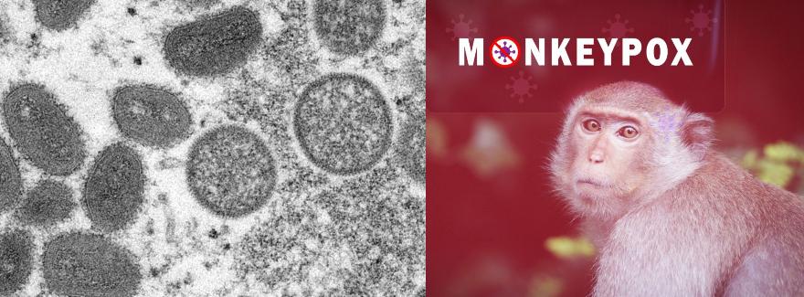 Variole du singe : origine et traitement