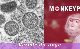 Variole du singe